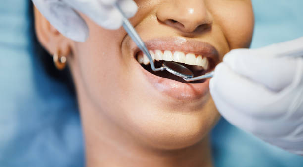 Best Emergency Dental Care for Broken or Chipped Teeth in West Milwaukee, WI